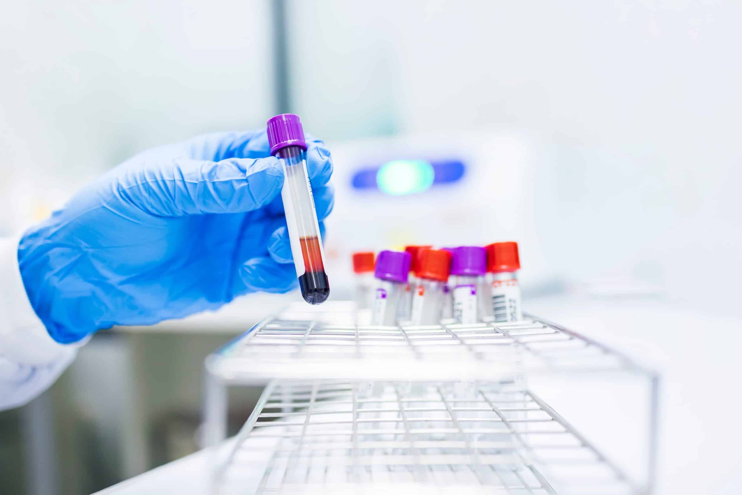 Genomic profiling of haematological malignancies