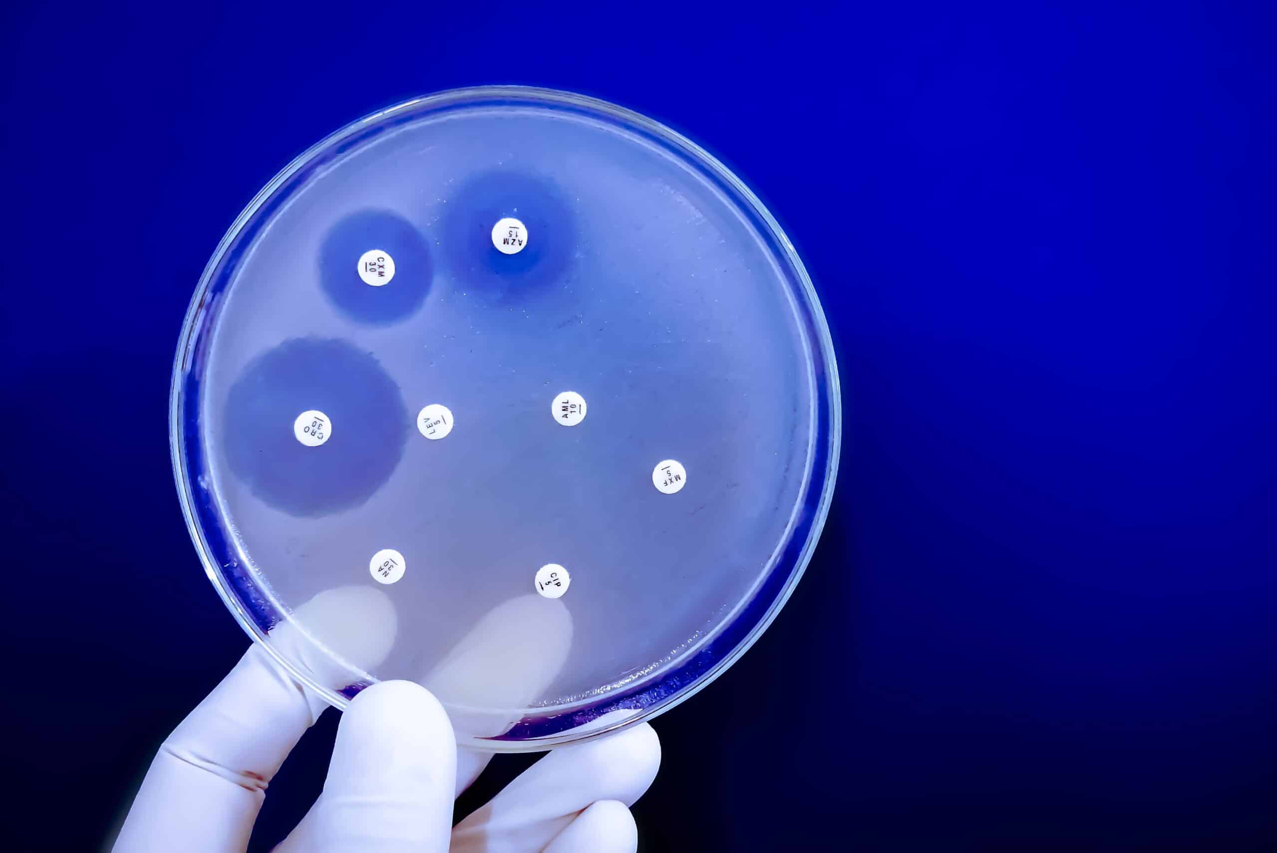 Targeting antibiotic resistant microbial infections with synthetic biology