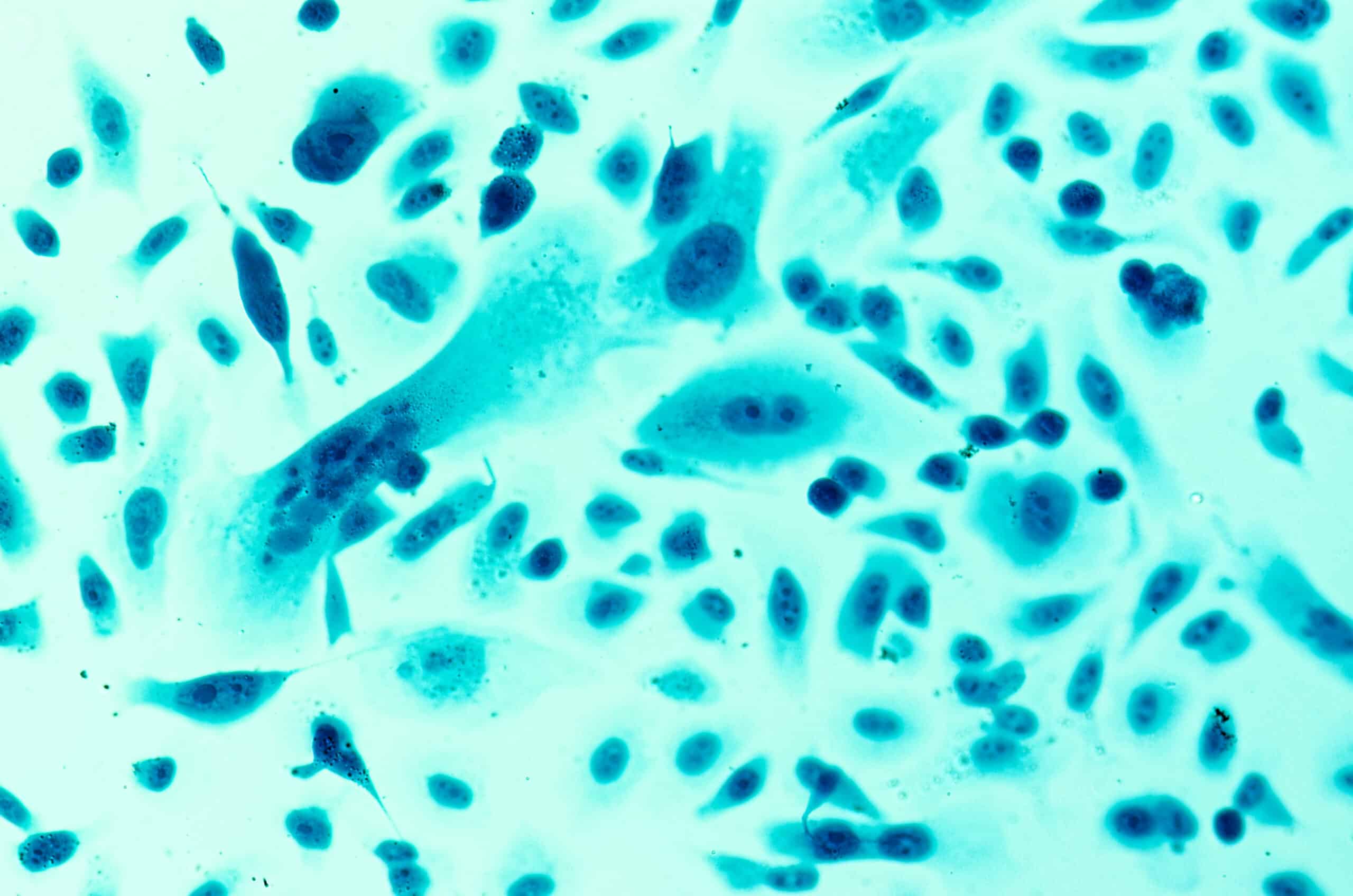 Cancer Research